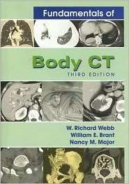 Fundamentals of Body CT, (1416000305), Nancy M. Major, Textbooks 