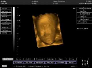 New arrival Full Digital Ultrasound Scanner10.4 inch high resolution 