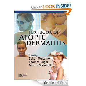 Textbook of Atopic Dermatitis (Series in Dermatological Treatment 