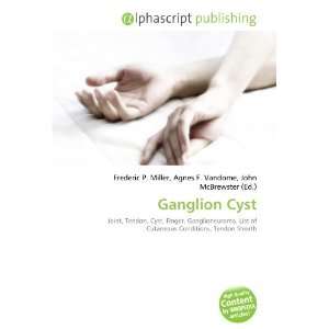  Ganglion Cyst (9786132782915) Books