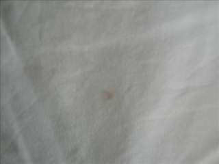 shoulder pea size spot at the mid back see pics payment must be 