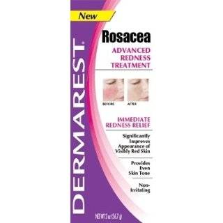  Prosacea Rosacea Treatment, Gel, 0.75 Ounces (Pack of 2 