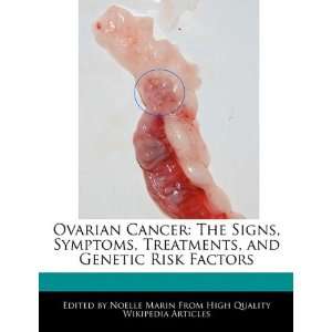  Ovarian Cancer The Signs, Symptoms, Treatments, and 